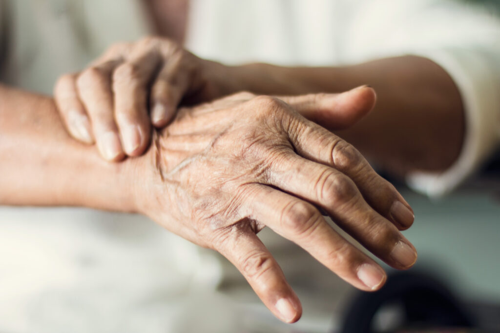 Close,Up,Hands,Of,Senior,Elderly,Woman,Patient,Suffering,From